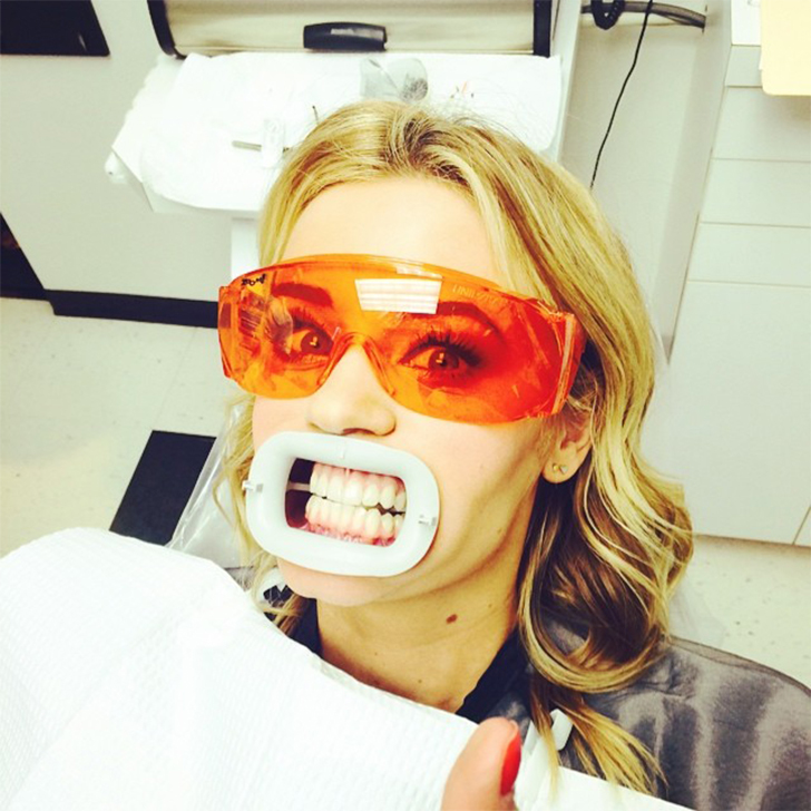 Zoom Teeth Whitening: My Experience