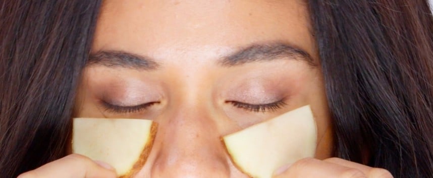 Undereye Circles