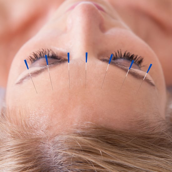 Skin Care Benefits of Acupuncture