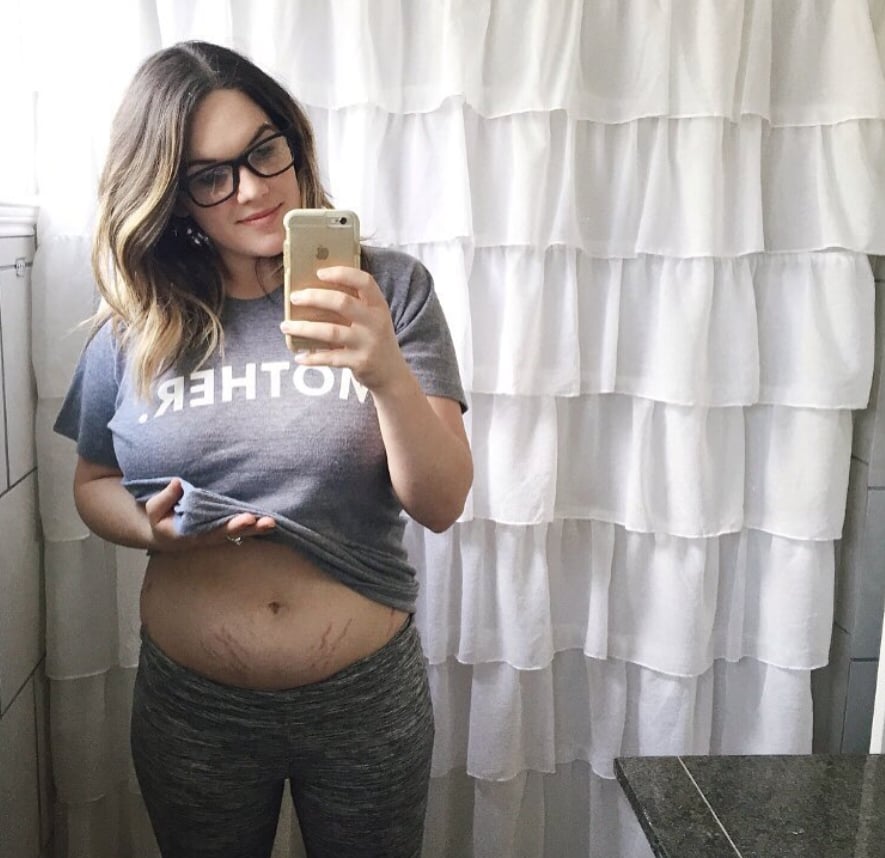 Two weeks postpartum, and this mom looks absolutely radiant.