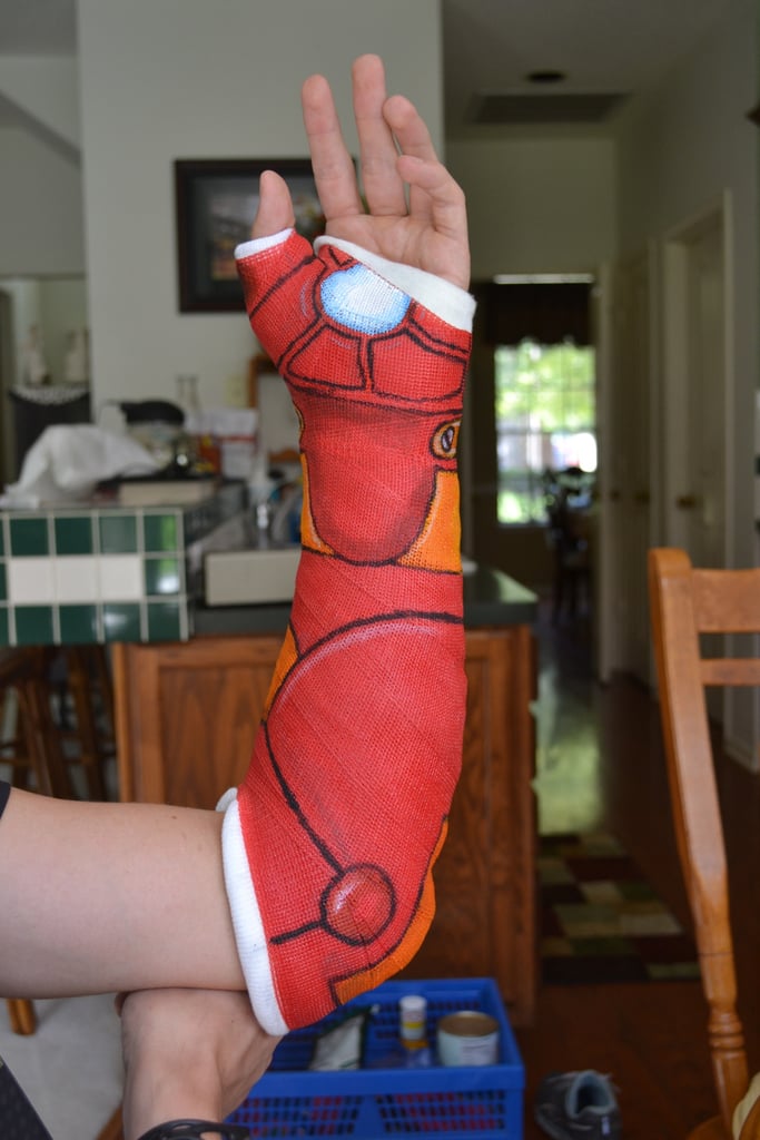 "Dealing with wearing a cast, you're doing it goddamn right."
Source: Imgur user steve699