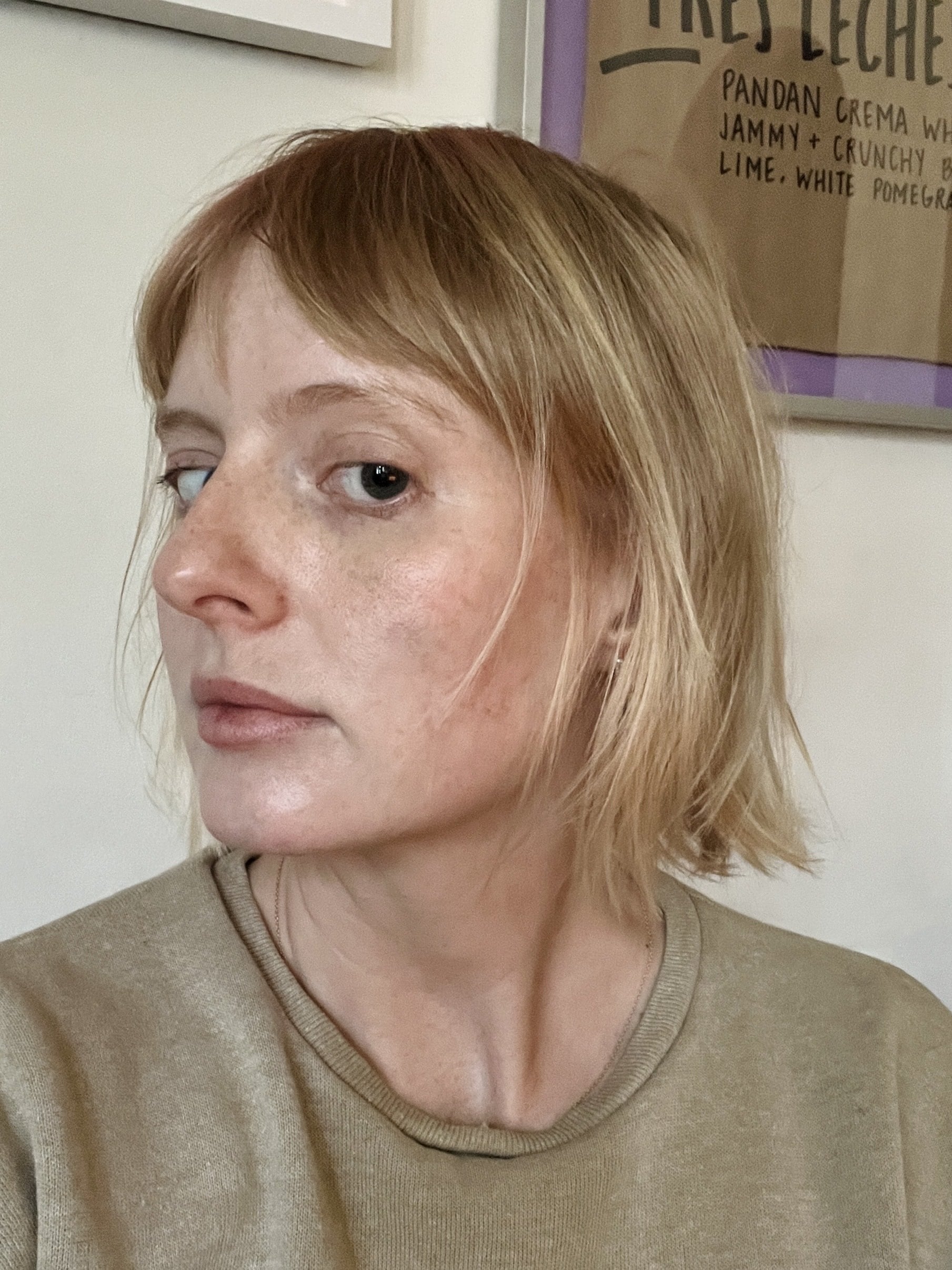 Immediately after SkinVive appointment