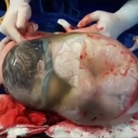 Video of Baby Born en Caul