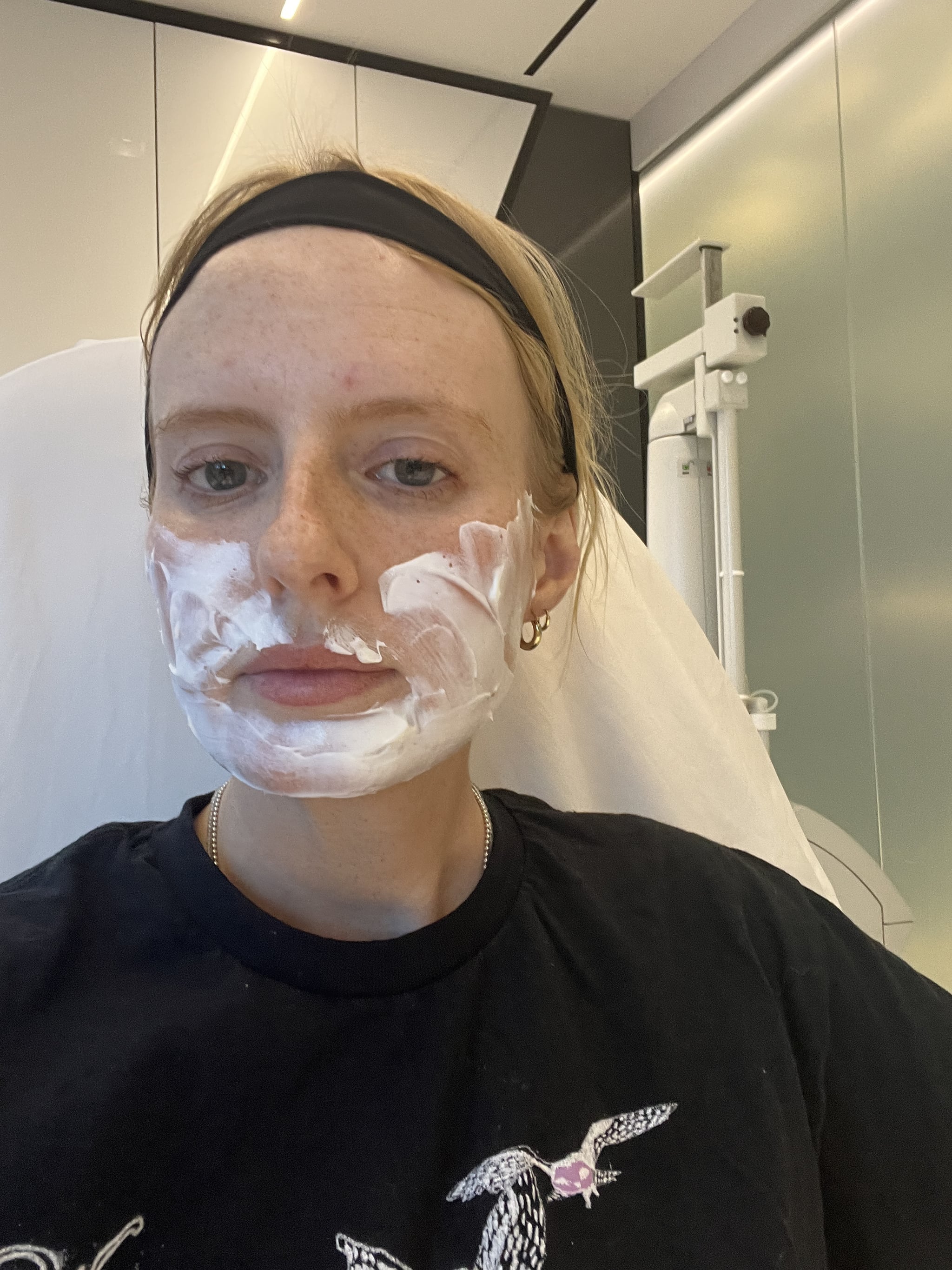 Before and after Ellacore skin-tightening treatment