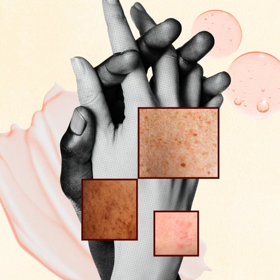 Couples Share How Skin Conditions Impact Their Relationship