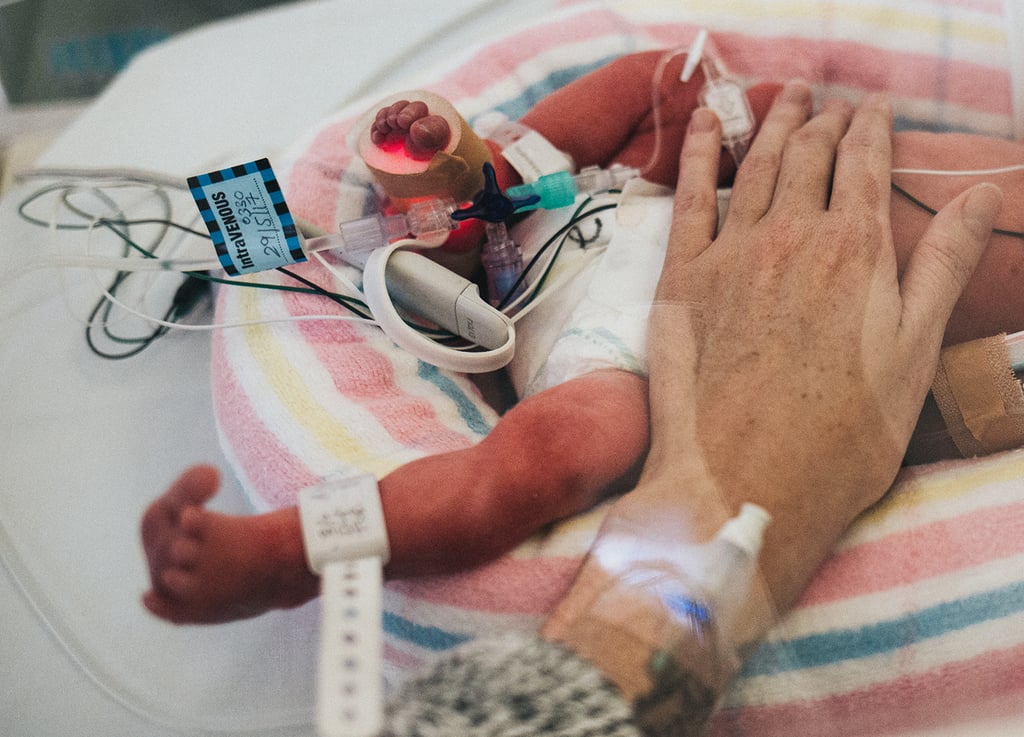 Photos of Premature Baby's Time in the NICU