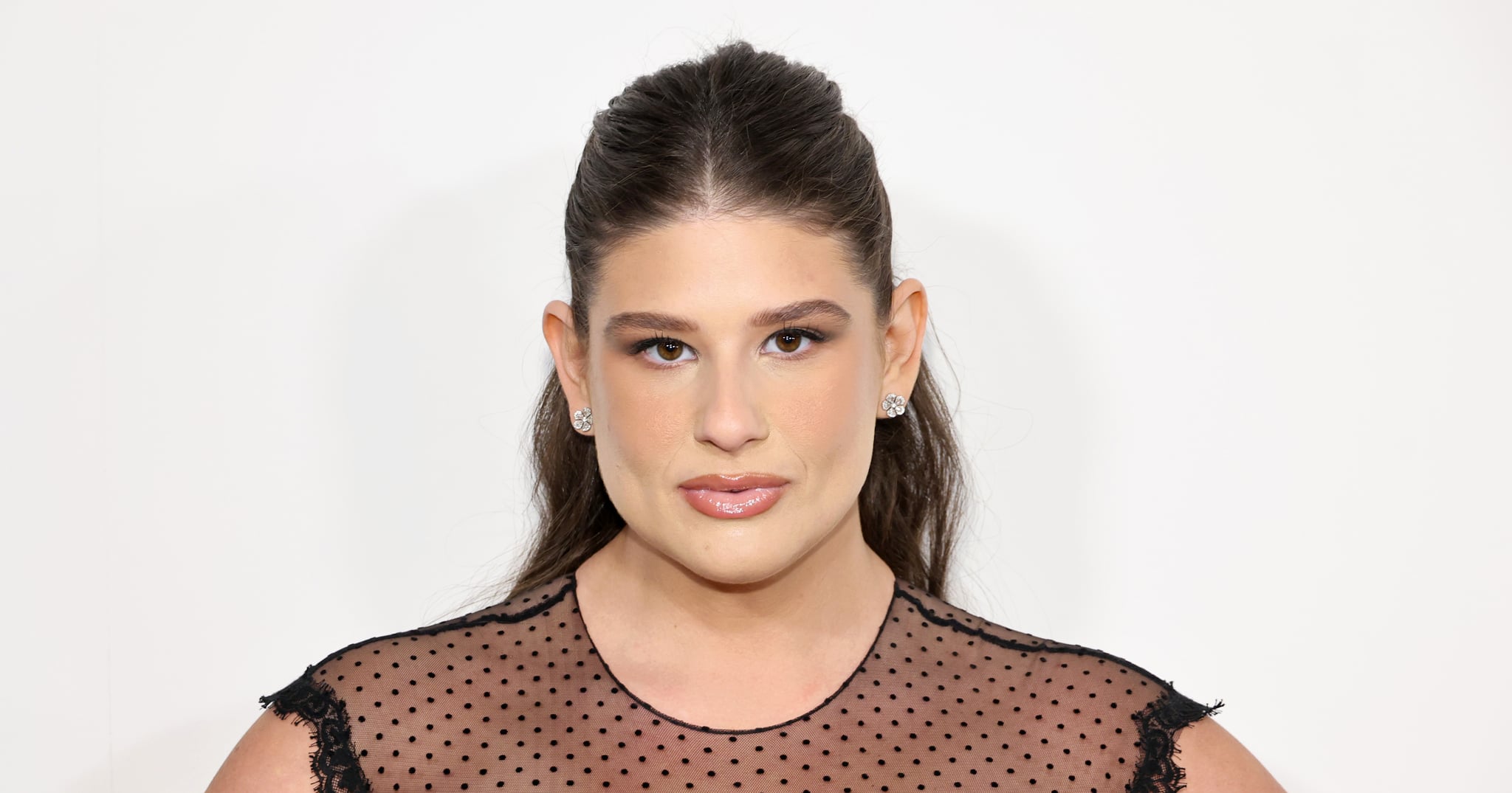 I Got Weight-Loss Surgery Like Remi Bader — No One Deserves the Shame