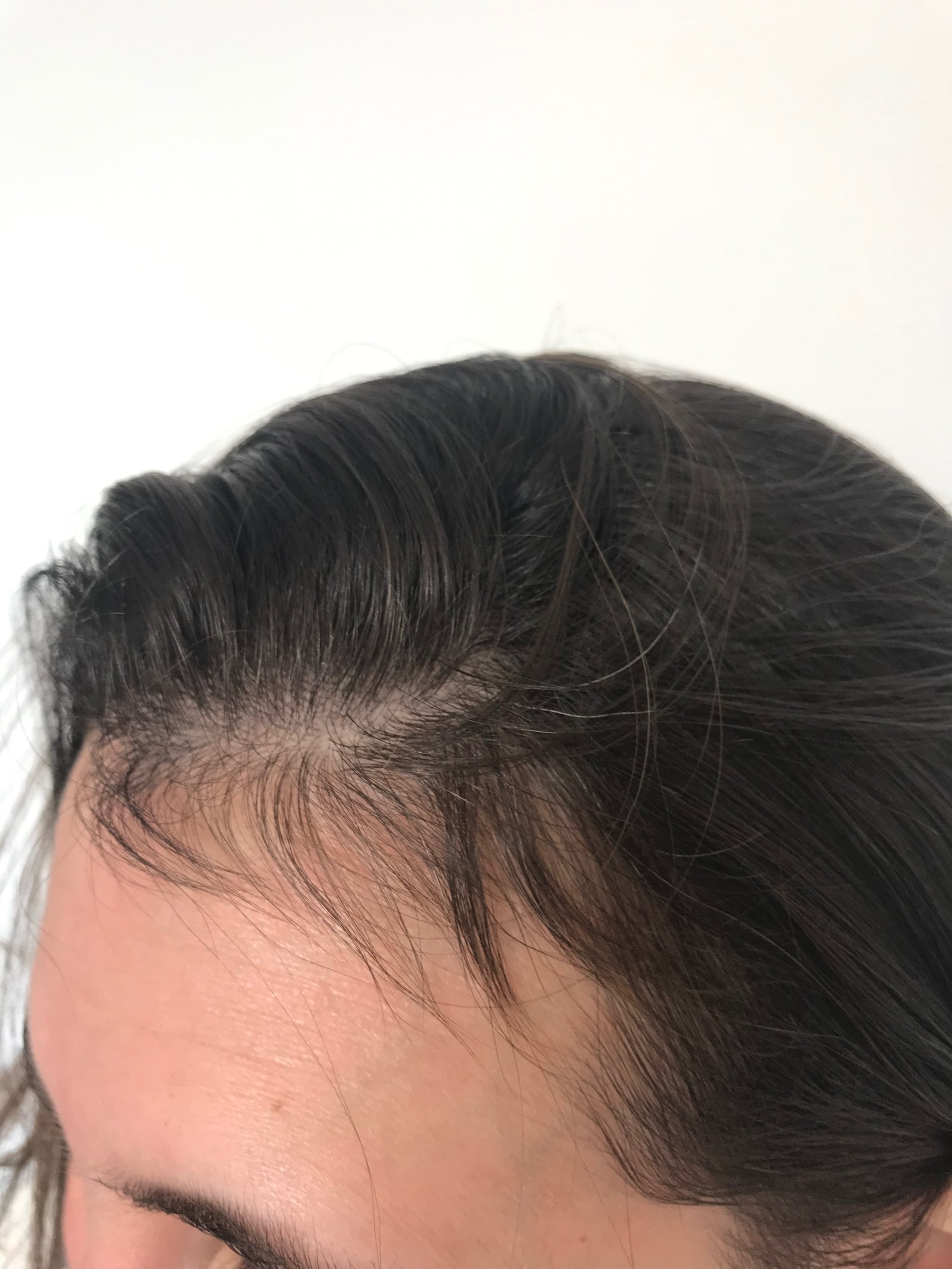 A close up of my regrowth. | I Asked the Internet For Help With My  Postpartum Hair Loss, and Here's What It Sent Me | POPSUGAR Beauty Photo 5