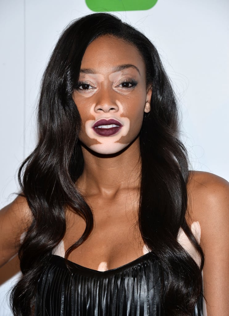 You probably recognize her from America's Next Top Model, and the gorgeous Winnie Harlow has undoubtedly been an inspiration for countless women struggling with skin conditions.
