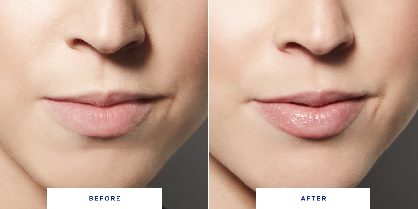 Lip Plumping Makeup Before and After 