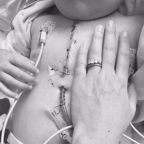 Mom Reflects on Son's Chest Scar Before Transplant Surgery