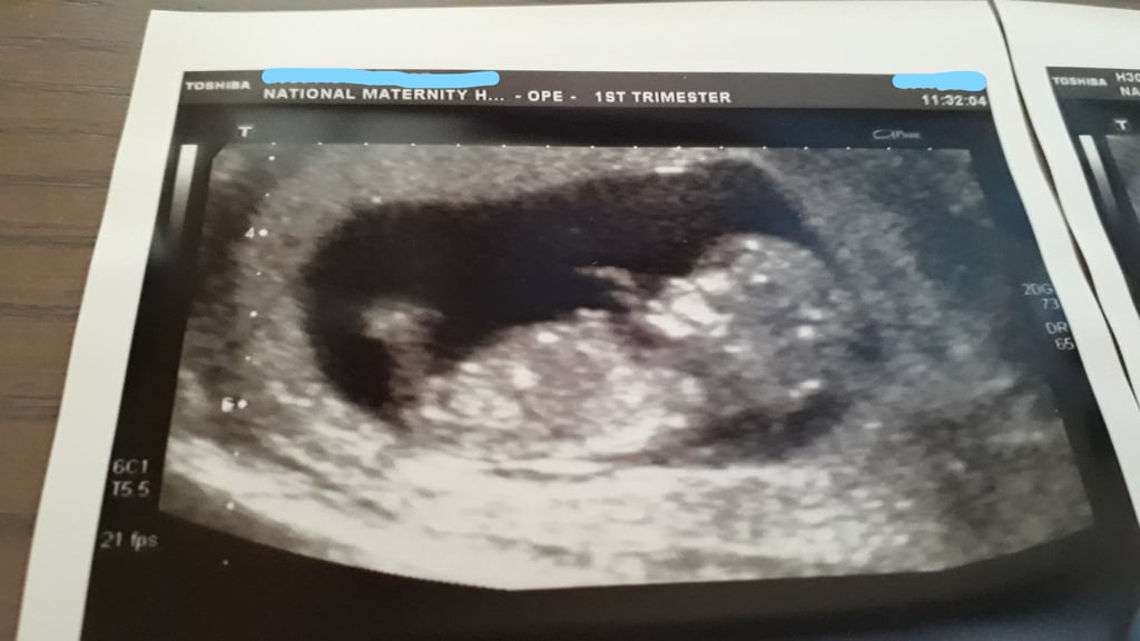 Sonogram Artwork