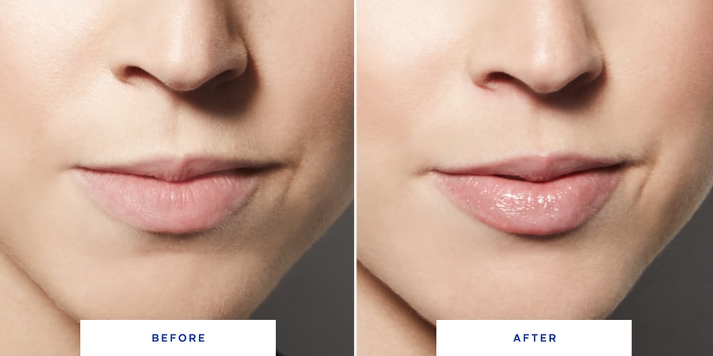 dior lip injection