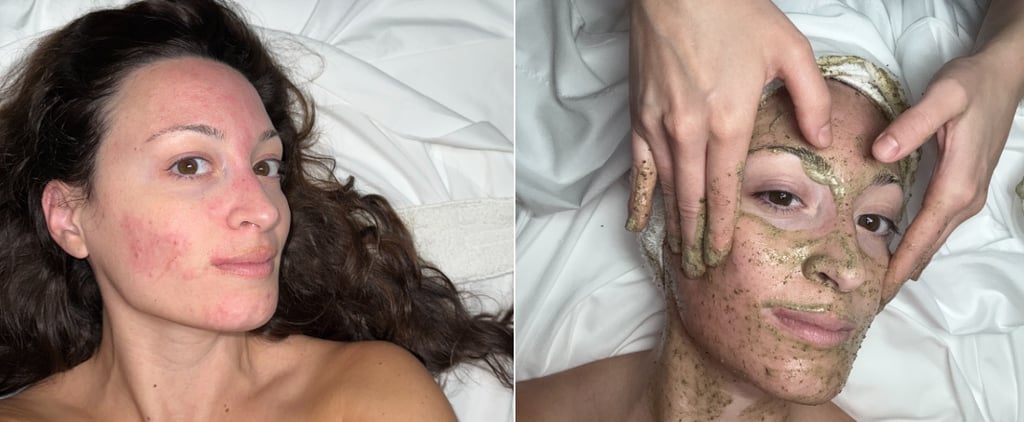 I Tried a Fiberglass Facial: Editor Experiment