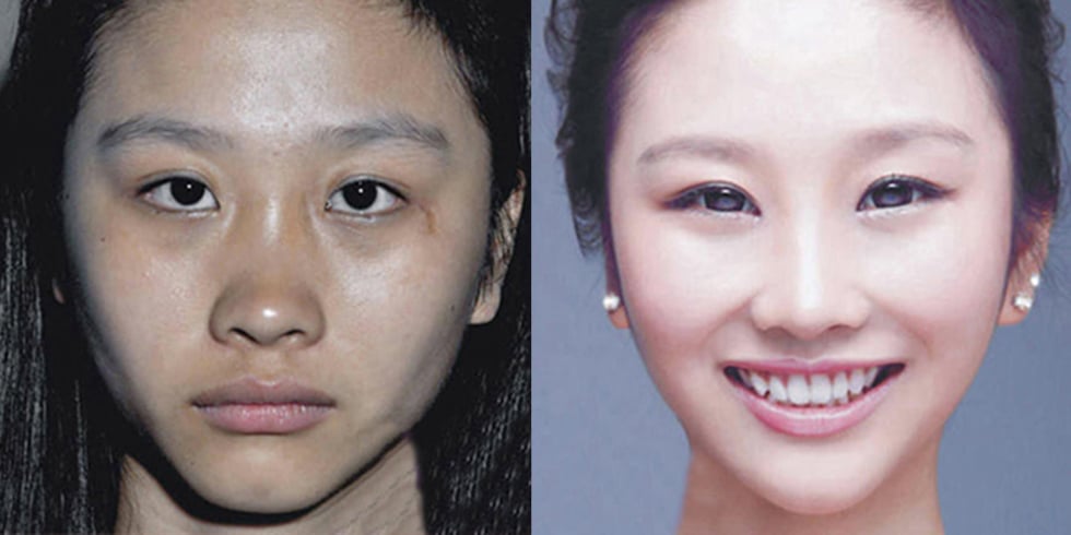 Extreme Plastic Surgery Causes Passport Confusion.