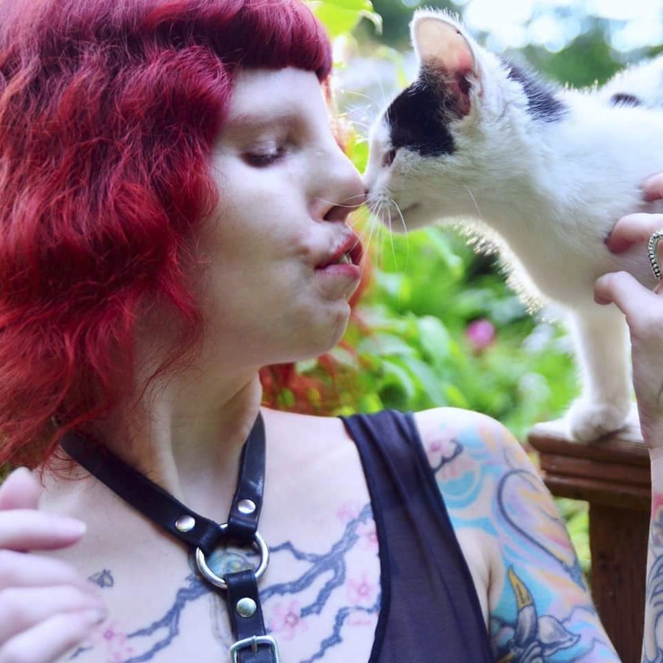 Cat Eye Syndrome Model | POPSUGAR Celebrity Cat Eye Syndrome Model | POPSUGAR Celebrity