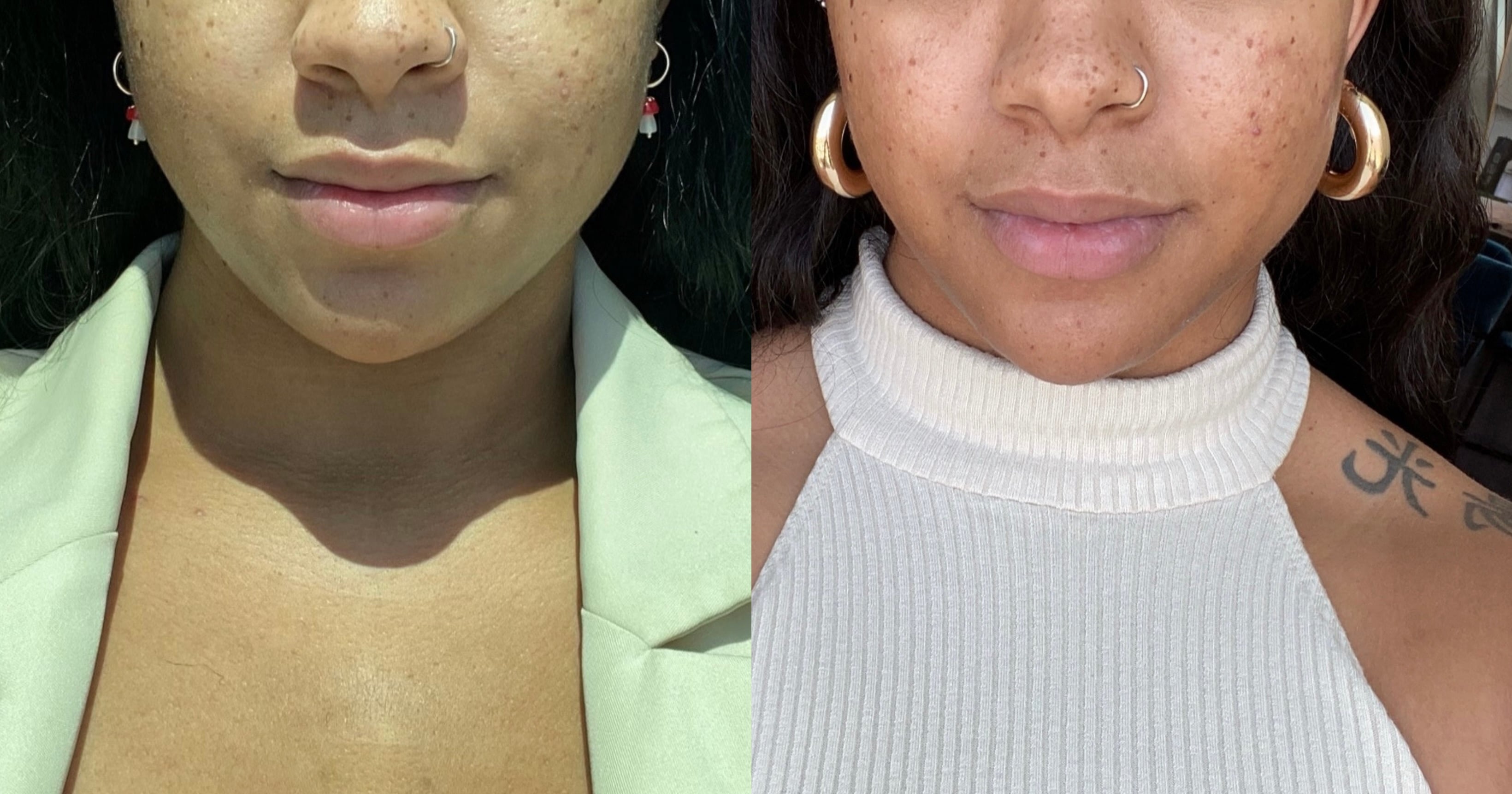 i-tried-the-celebrity-favorite-forma-facial-treatment-popsugar-beauty