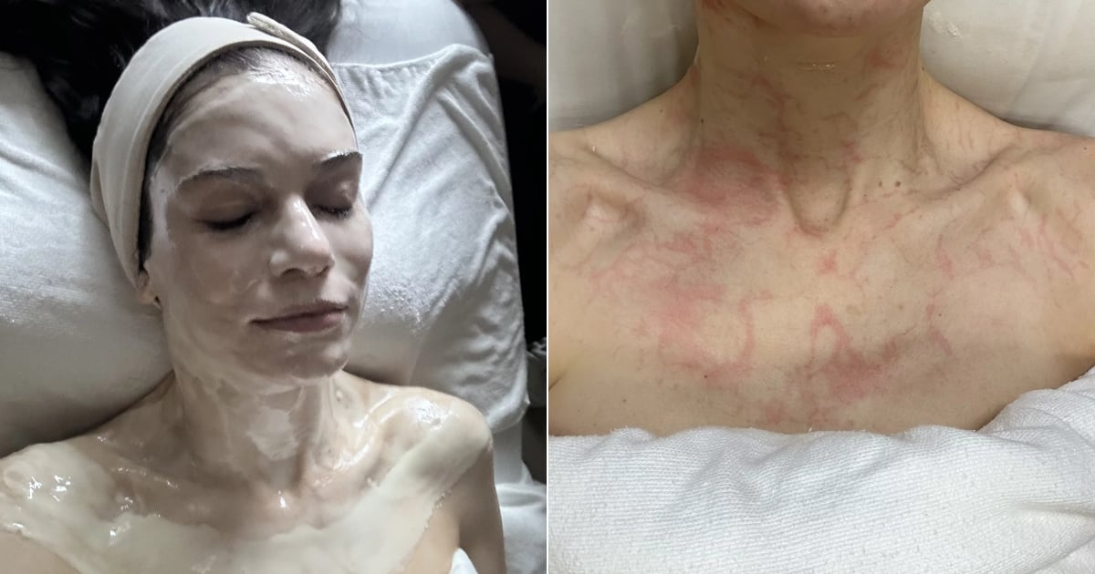 This “Zombie Facial” Is Wild, Weird, and 100% Worth It
