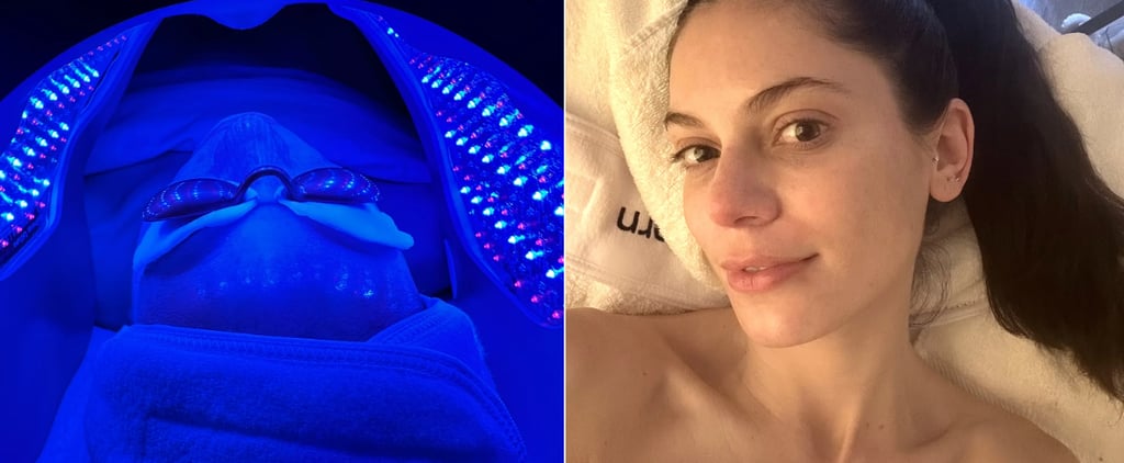 I Tried a $1,600 Liquid Facelift: See Photos
