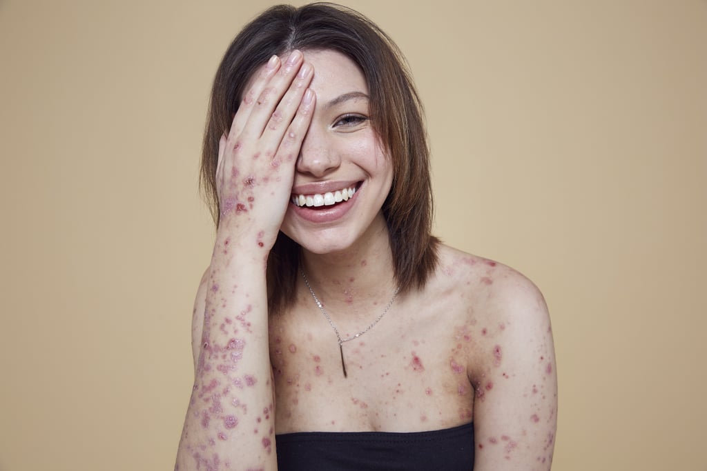Missguided In Your Own Skin Campaign 2018 Missguided In Your Own Skin Campaign 2018