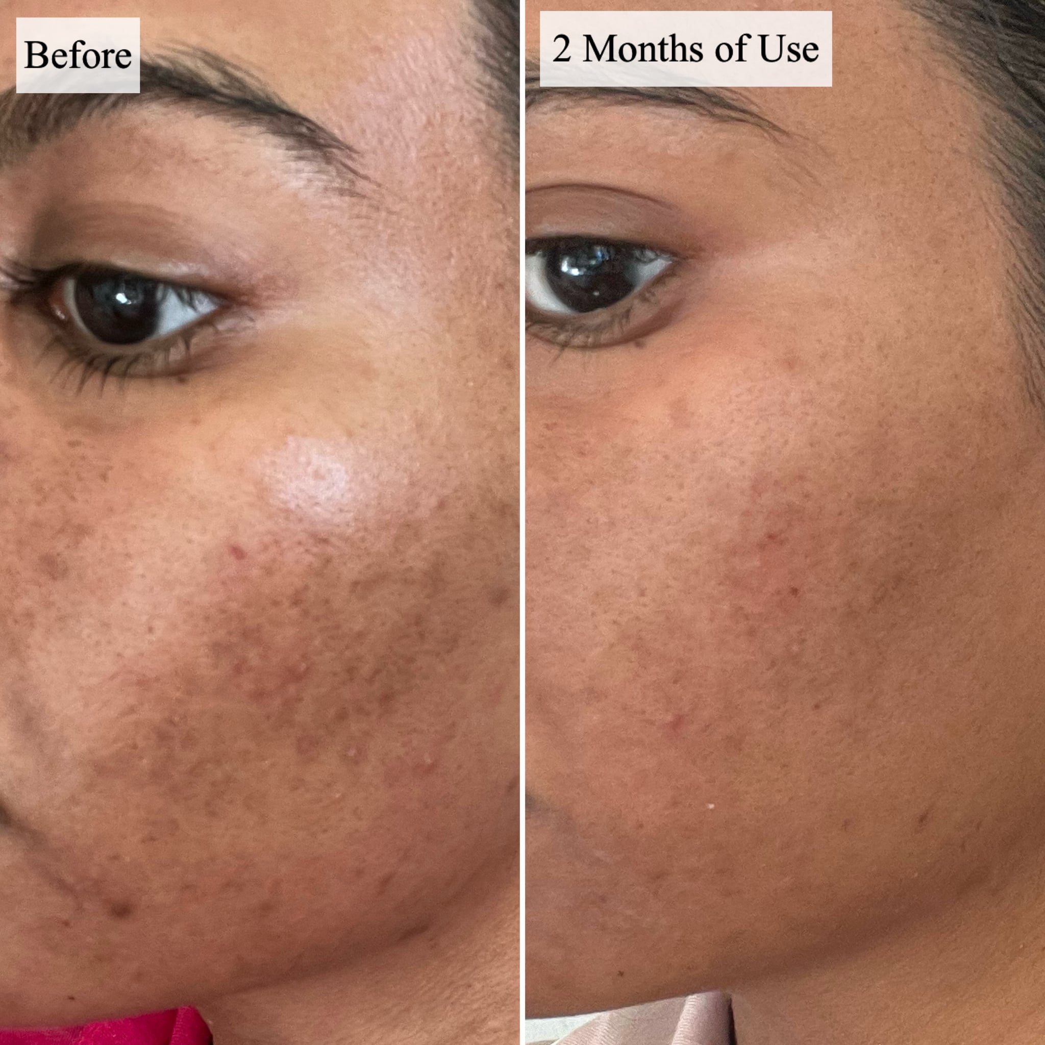 Before and after using the Caudalíe Vinoperfect Radiance Serum for two months.