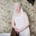 13 Spellbinding Portraits of People With Albinism