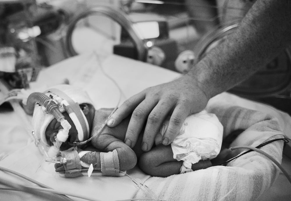 Photos of Premature Baby's Time in the NICU