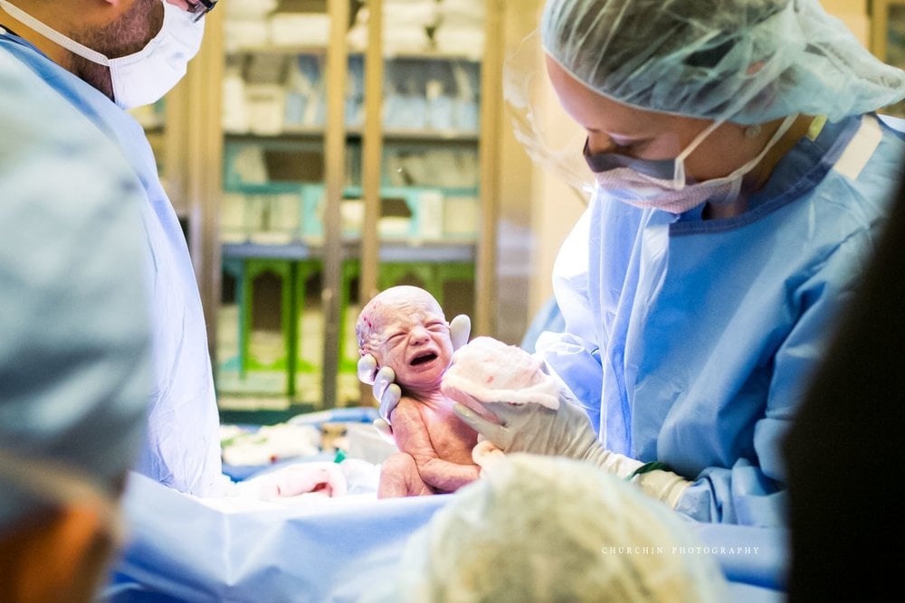 C-Section Birth Photography
