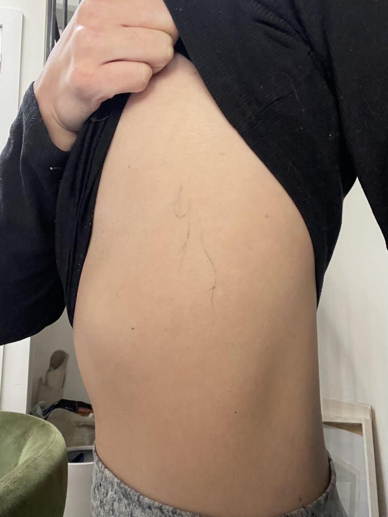 Ephemeral tattoo fading after one year, six months