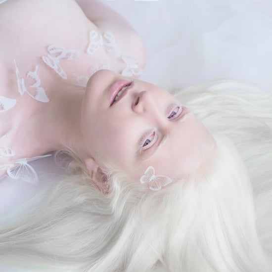 Albinism Photographs | Yulia Taits