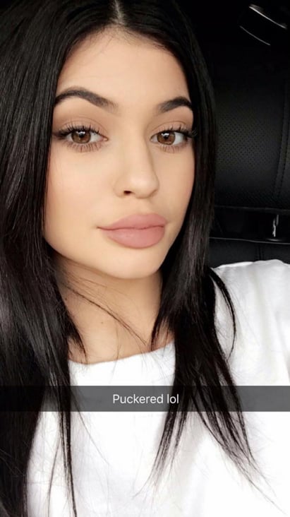 Kylie’s puckered look, showcasing pursed lips. | Kylie Jenner Lip ...