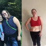 I Have Loose Skin From Weight Loss, and I'm Choosing to Embrace It