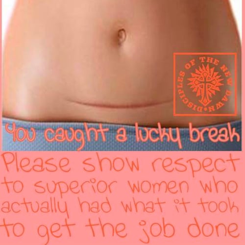 C-Section Shaming Ad Campaign