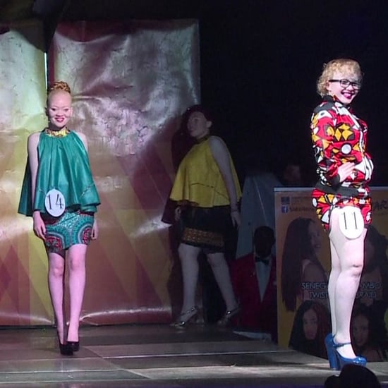 Albinism Beauty Pageant (Video)