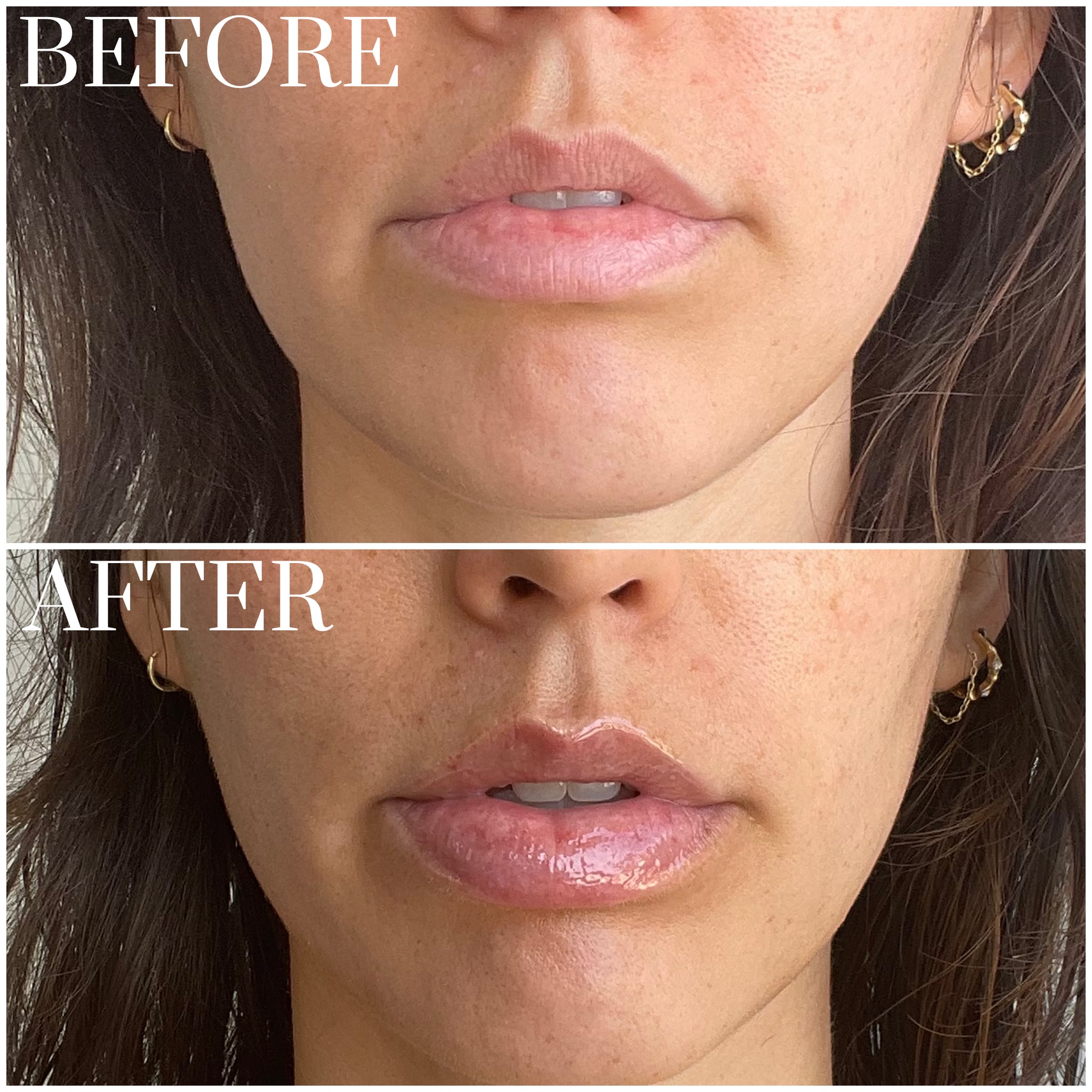 Rhode Peptide Lip Treatment Review With Photos | POPSUGAR Beauty