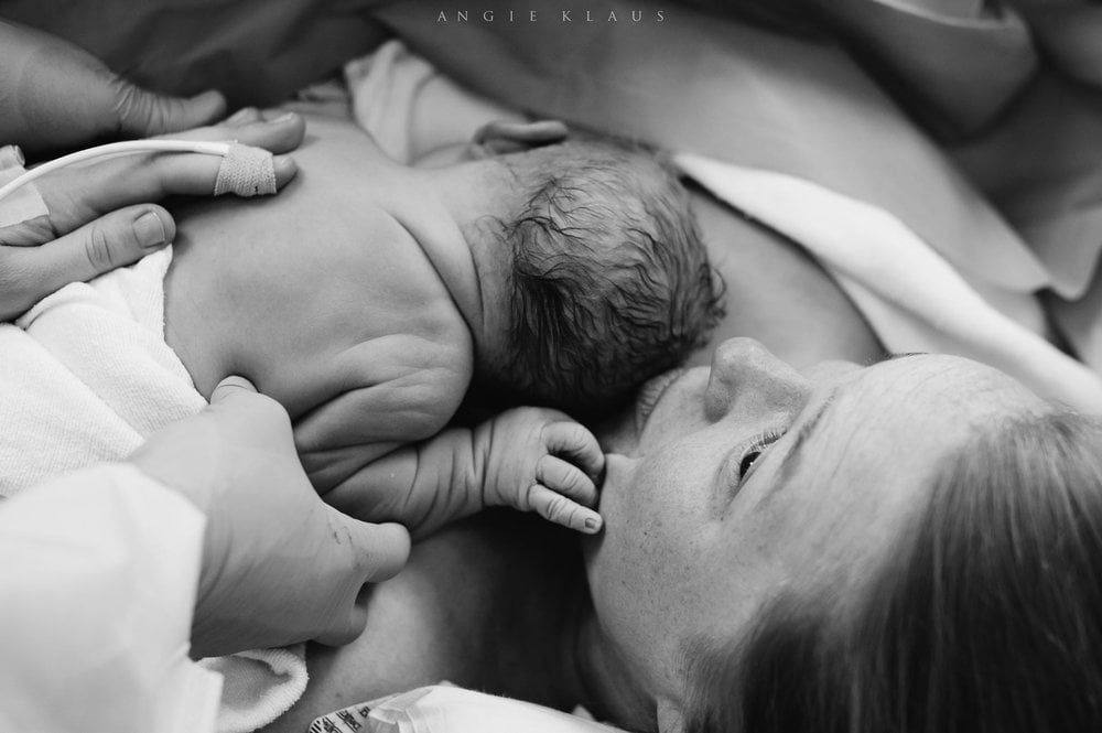 C-Section Birth Photography
