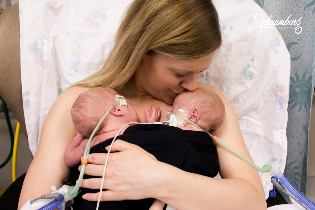 Moms Skin-to-Skin Bonding With Their Newborns in the NICU