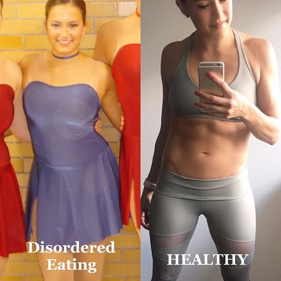 Eating Disorder Before and After