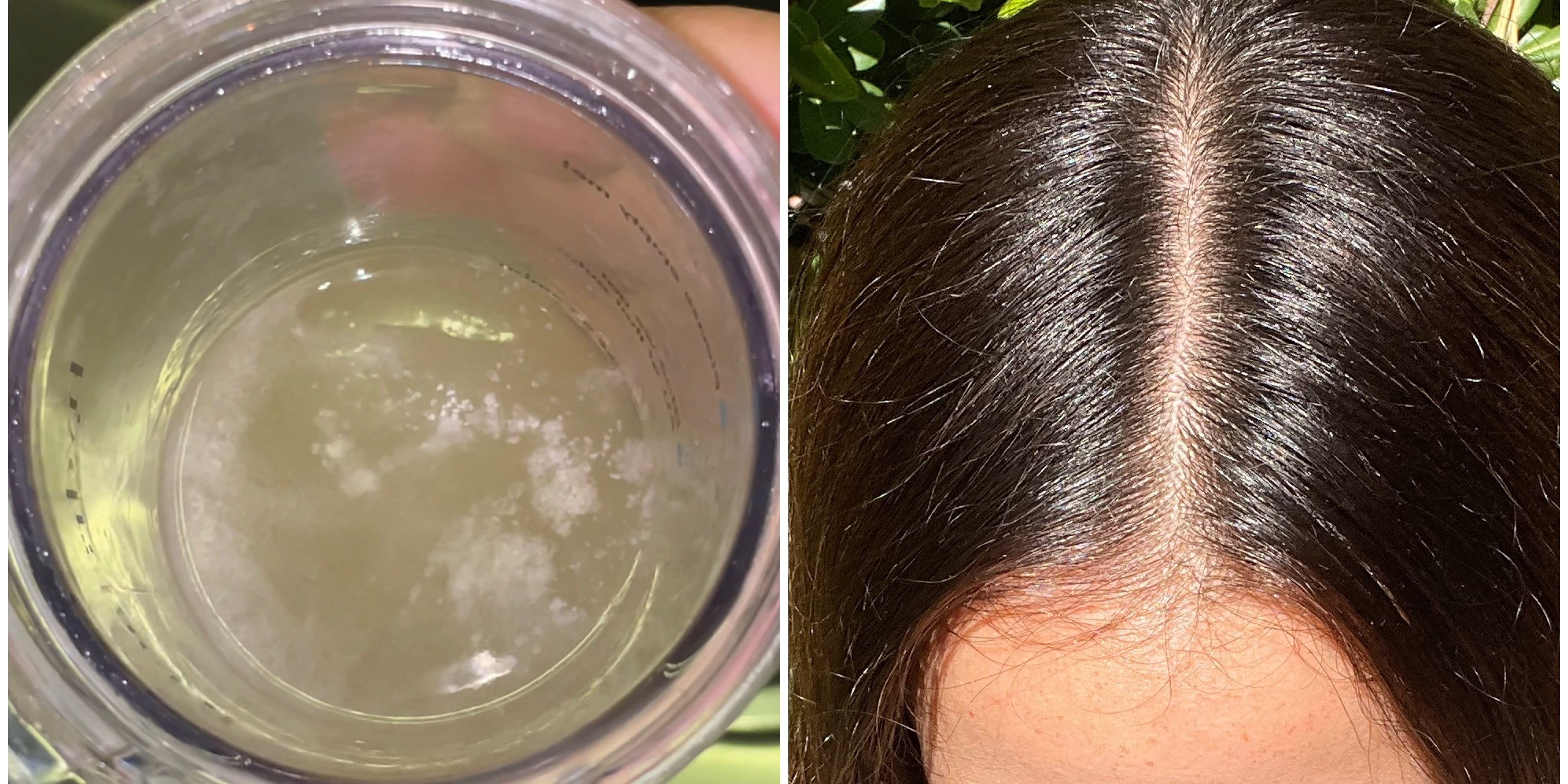 My Scalp Was Itchy and Dry Until I Tried a "Scalp "Detox"