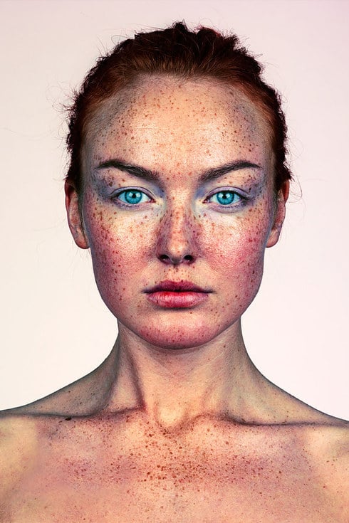 Photos of People With Freckles