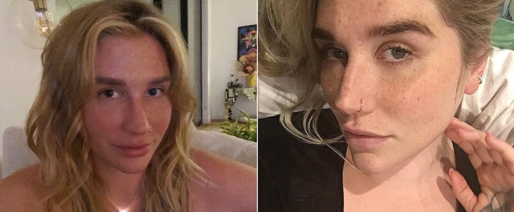 Photos of Kesha With No Makeup