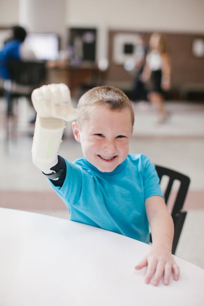 Boy Receives Prosthetic Arm From 3D Printer