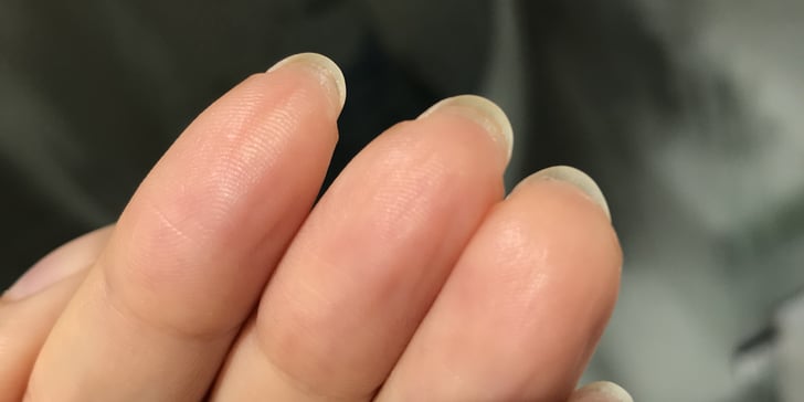 Why does the skin around my nails peel so much even when I moisturize my  hands alot??? How do I fix this? : r/malegrooming