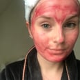 People on TikTok Call This $7 Treatment a "Blood Mask" — I Call It My Ticket to Baby-Soft Skin