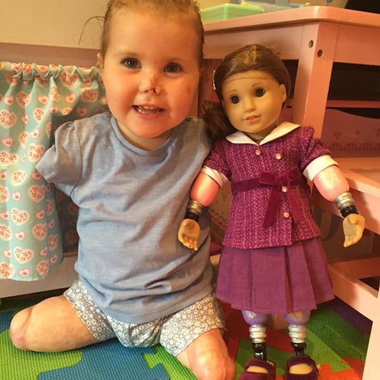 Amputee Girl Gets American Girl Doll With Prosthetic Limbs