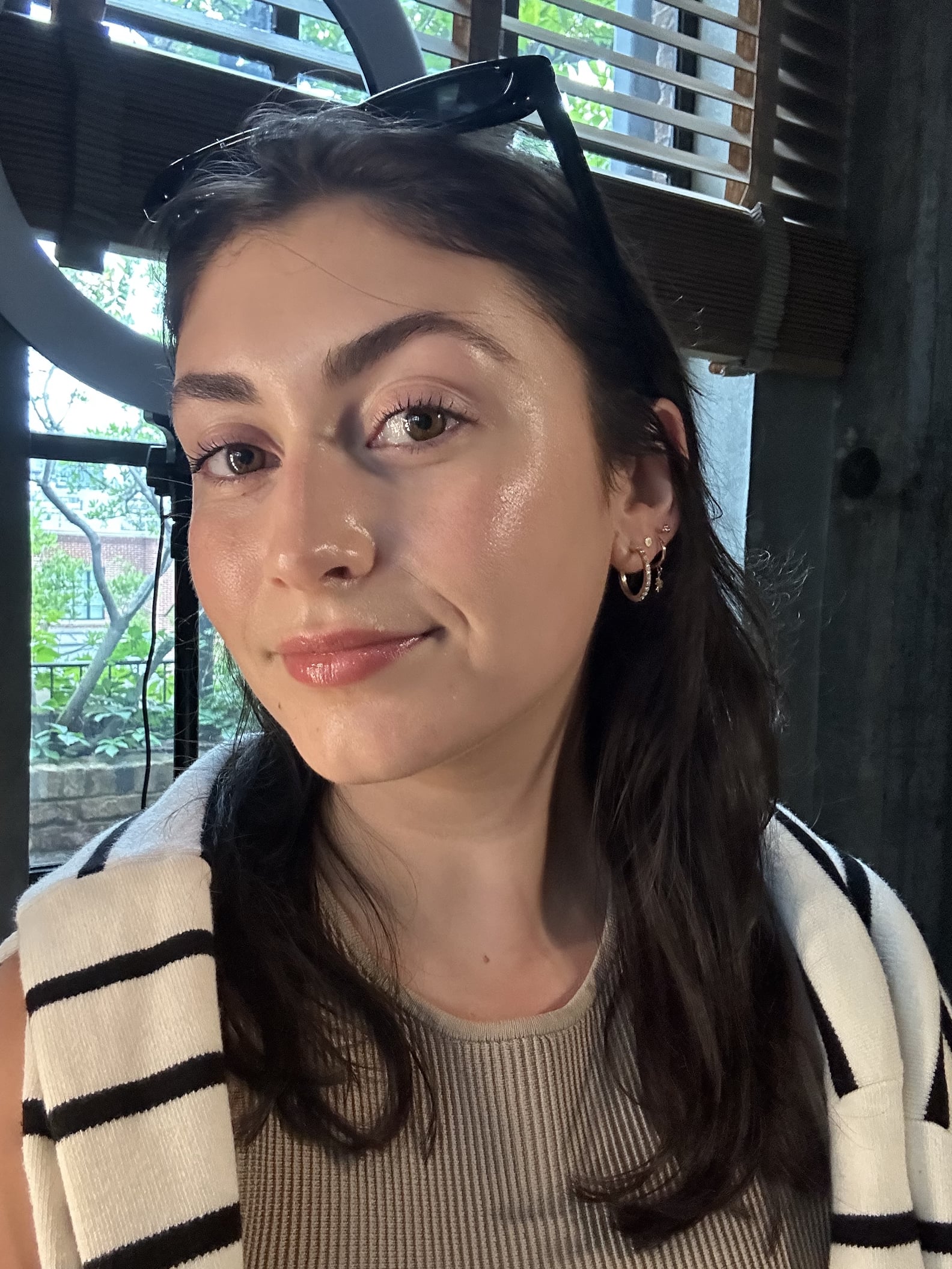 Laser Genesis Treatment Review With Photos POPSUGAR Beauty