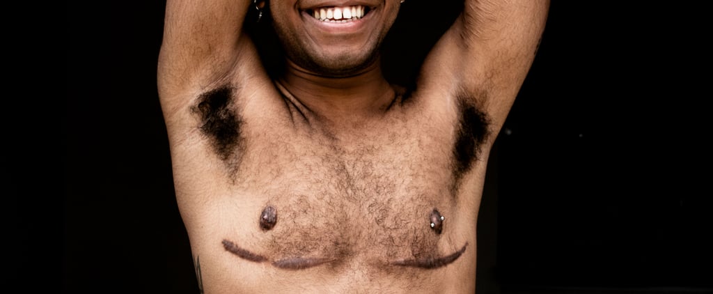 What to Know About Top-Surgery Scars, According to Plastic Surgeons