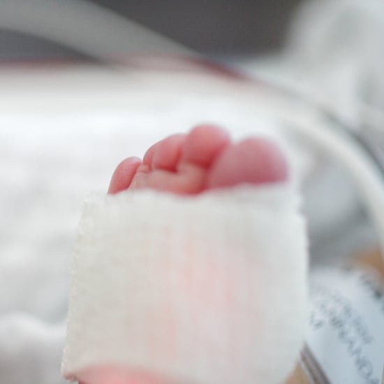 How to Get Rid of Hair Tourniquets From Baby Toes