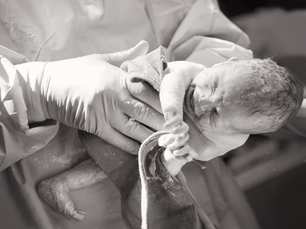 Photographs of Twin Birth