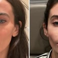 I Tried The Viral "Lip Tenting" Filler Technique